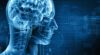 Hersenscan van stervende man toont 'leven dat aan hem voorbij flitst'