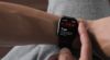 Hartscan Apple Watch krijgt praktijktest in Nederland: 'Beroertes voorkomen'