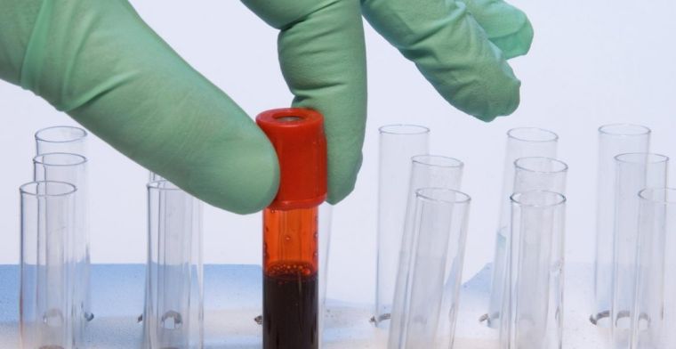 'Universele bloedtest voor kanker mogelijk door bacterie-analyse'