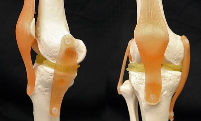 Nieuwe gel voor 3D-printen van nieuwe meniscus