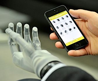 Geavanceerde handprothese bedien je met een iPhone