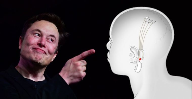 Bedrijf Elon Musk gaat hersenimplantaten testen bij mensen