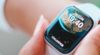 Bandjes smartwatch broeinest van bacteriën: welk type bandje scoorde het beste?